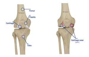 Mr David Booth - Melbourne Orthopaedic Hip and Knee Surgeon